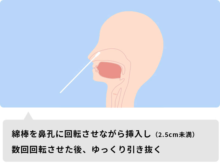 鼻腔ぬぐい液