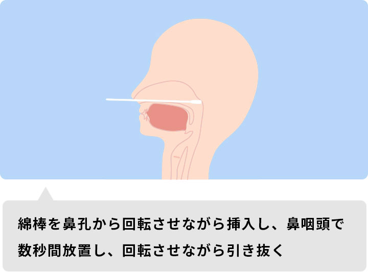 鼻咽頭ぬぐい液