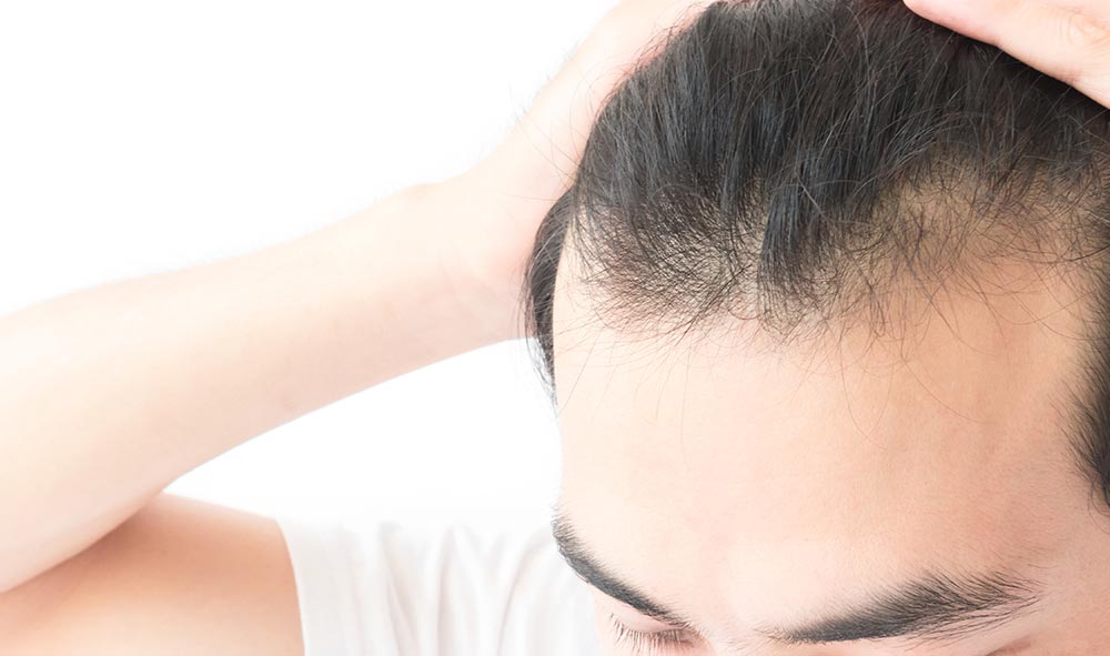 <br />
<b>Warning</b>: Undefined variable $parentTopJp in <b>/home/shibuya3/shibuya3clinic4men.com/public_html/wp-content/themes/shibuya3clinic-theme2025/single.php</b> on line <b>78</b><br />